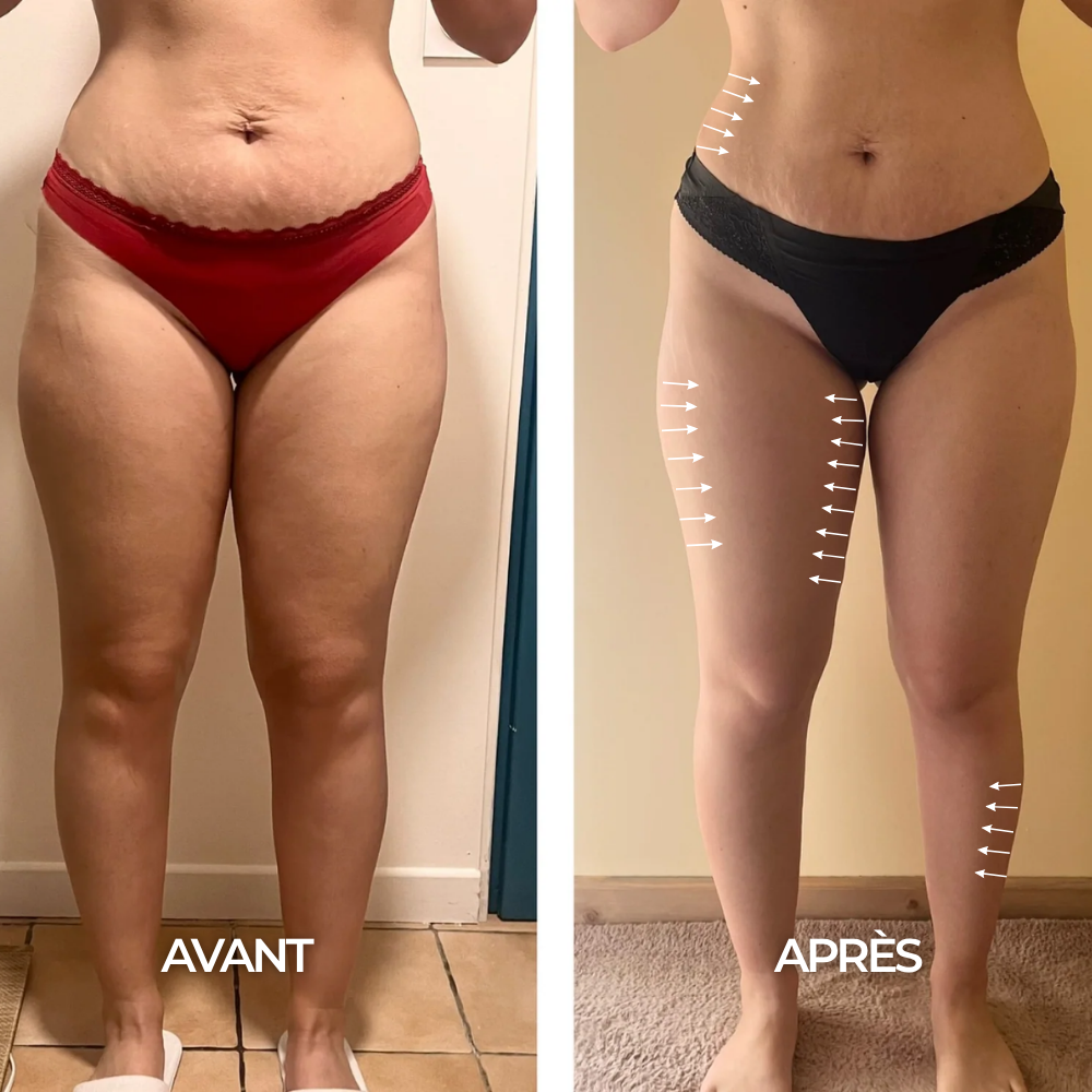 Krople Wellness Drenaż Limfatyczny - 59ml